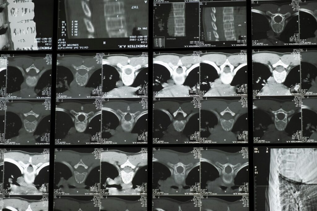 High-resolution radiological images showcasing the complex structure of the human spine for medical examination.